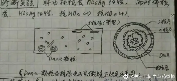 中医治疗乙肝:中草药药理治疗乙型肝炎思路-木子李笔记
